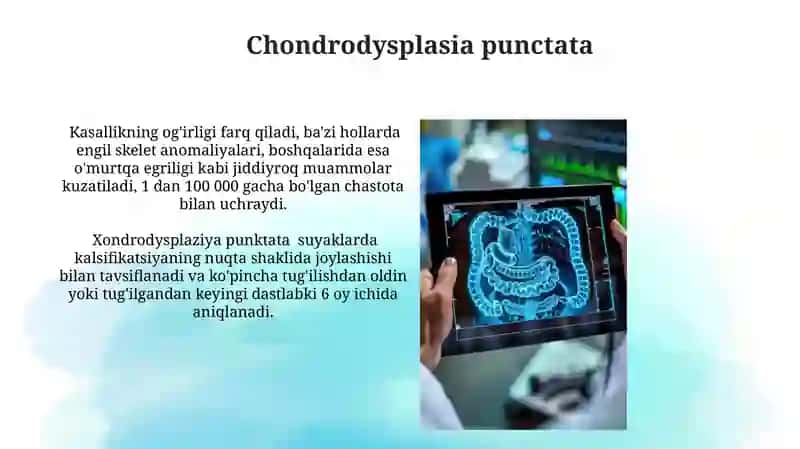 Fibrozli Displaziya 4