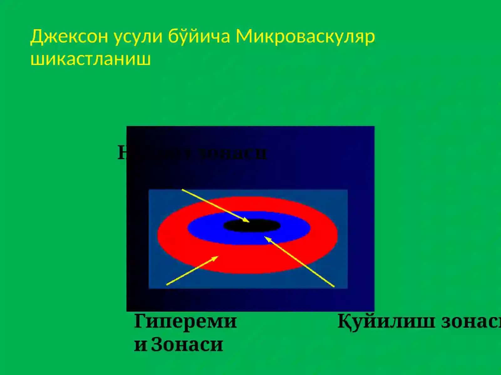 Термик шикастлар. Комбинациялашган шикастлар 4