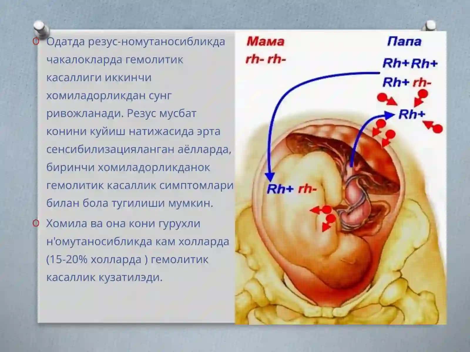 Чақалоқларда сариқлик. ЧГК 4
