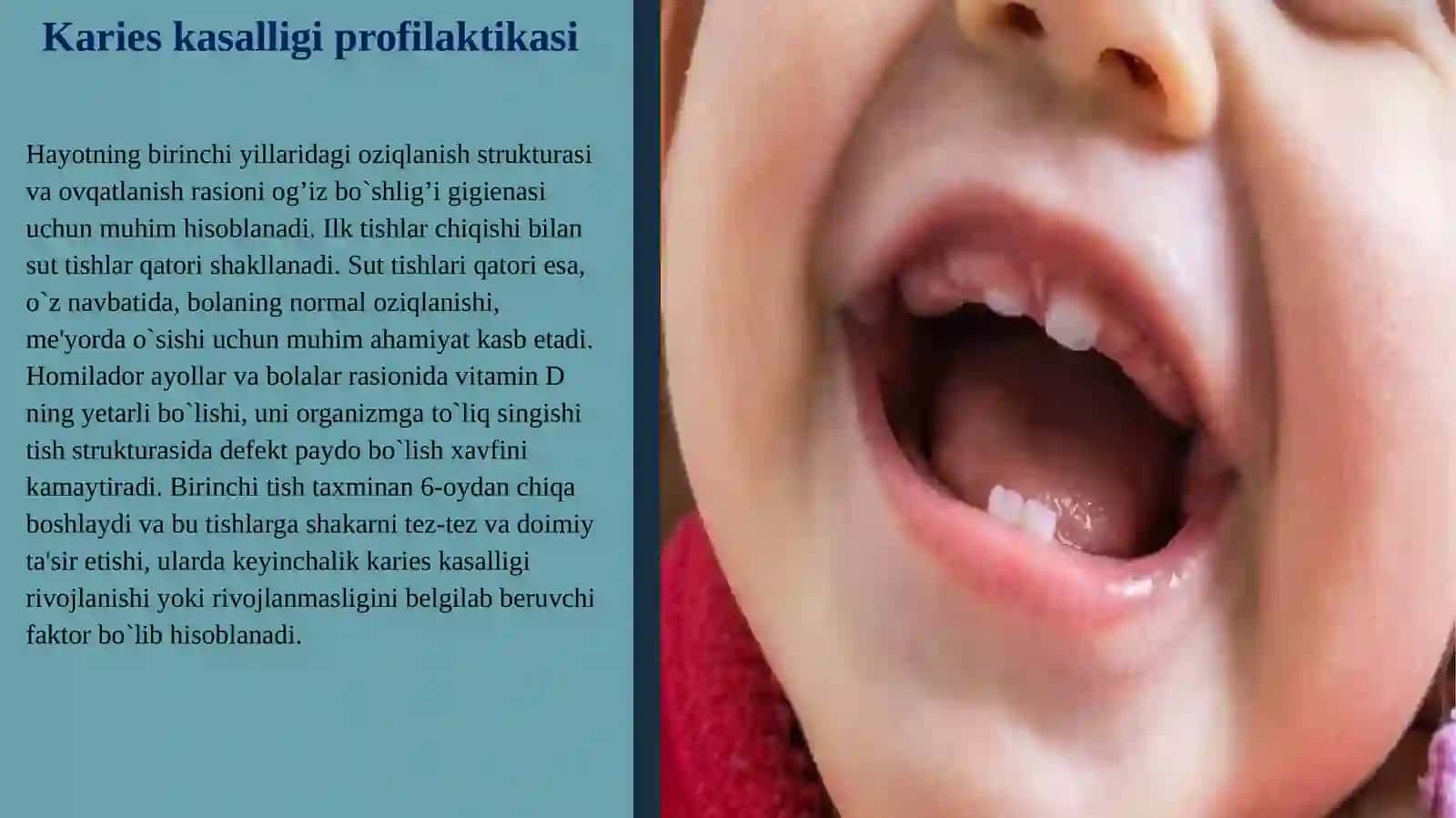 Karies kasalliginiprofilaktikasi 4