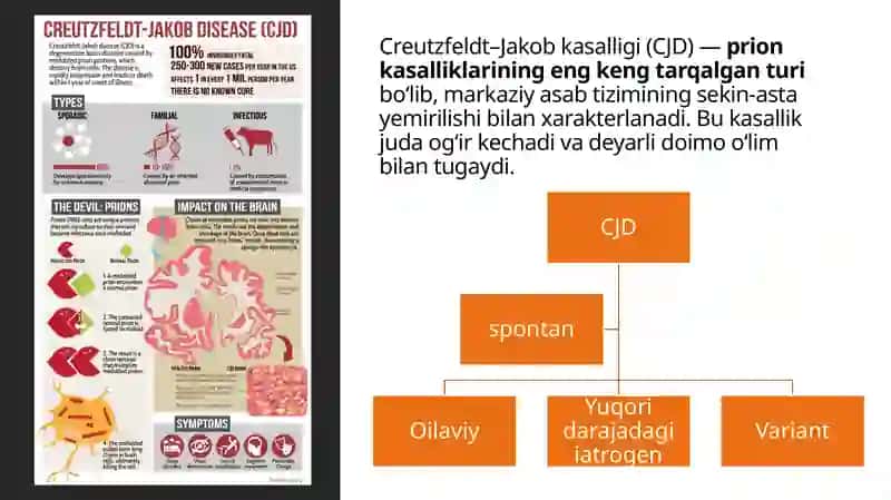 Prion kasalliklari 4