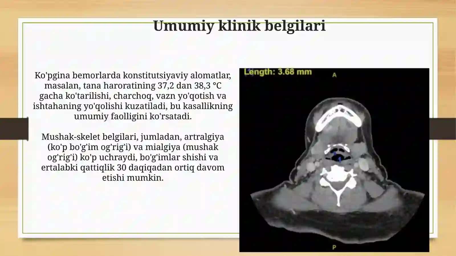 Diffuz biriktiruvchi toʻqima kasalliklarida umumiy belgilarvasindromlar 4