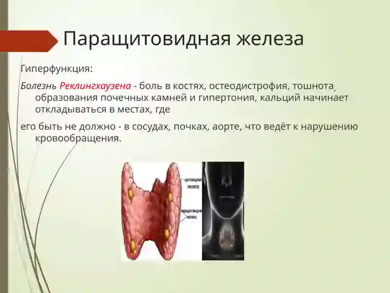 Эндокринные нарушения 4