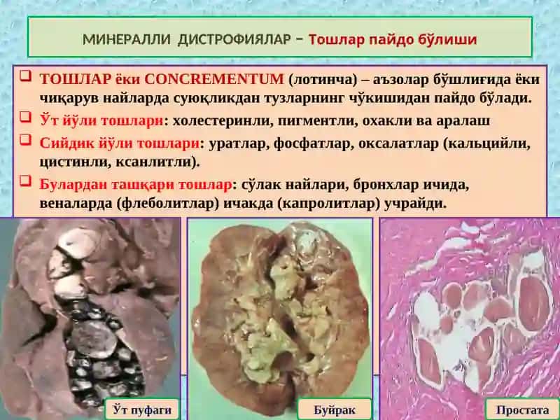 ПАТОЛОГИК АНАТОМИЯ КУРСИ 4 Маъруза 4