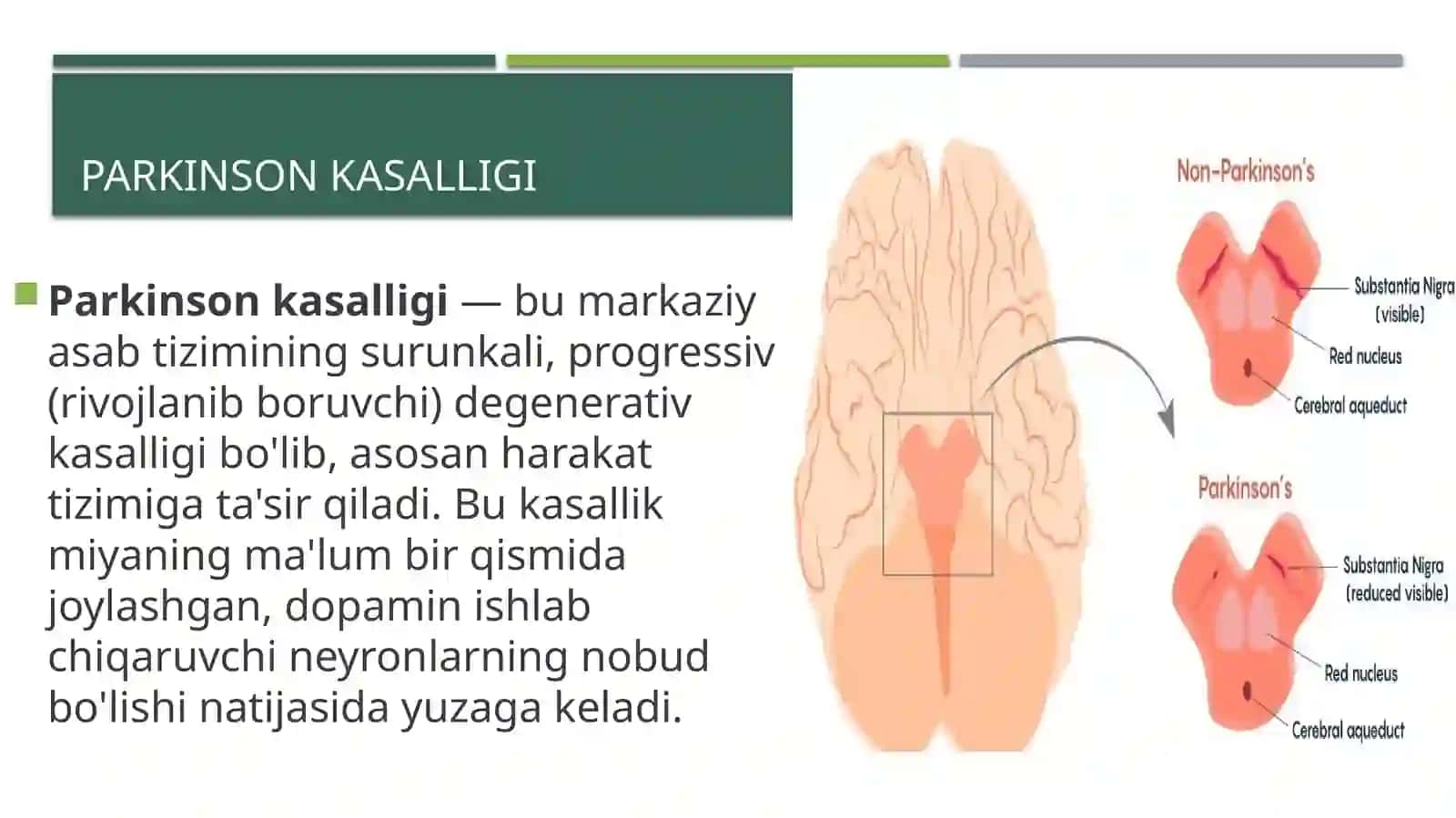 nerv sistemasining degenerativ kasalliklari 4