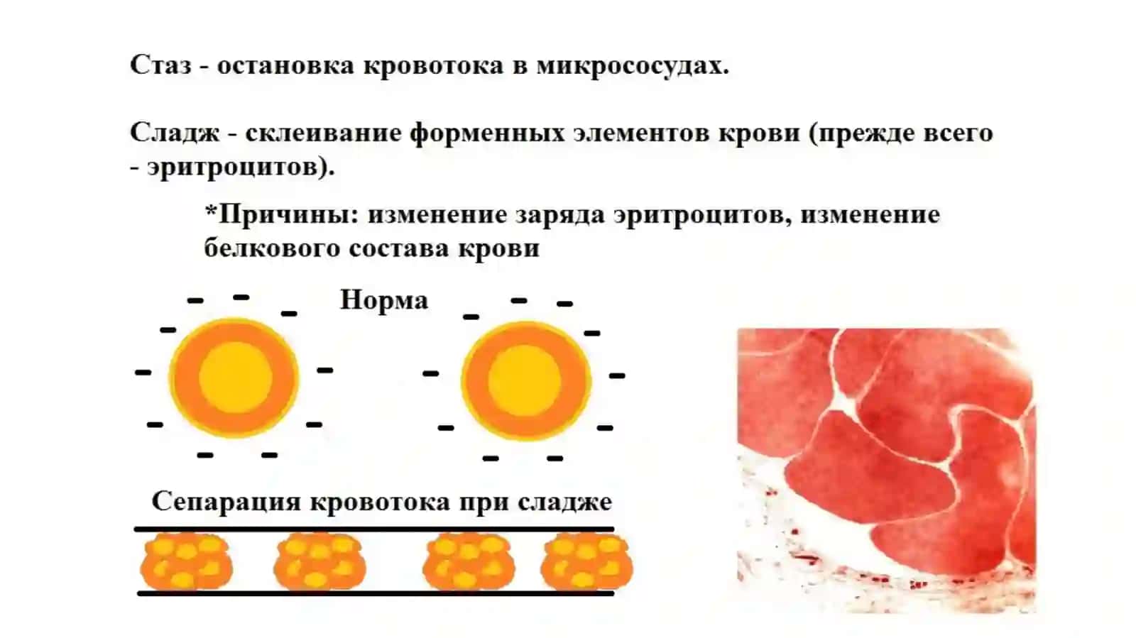 Расстройства кровообращения 4