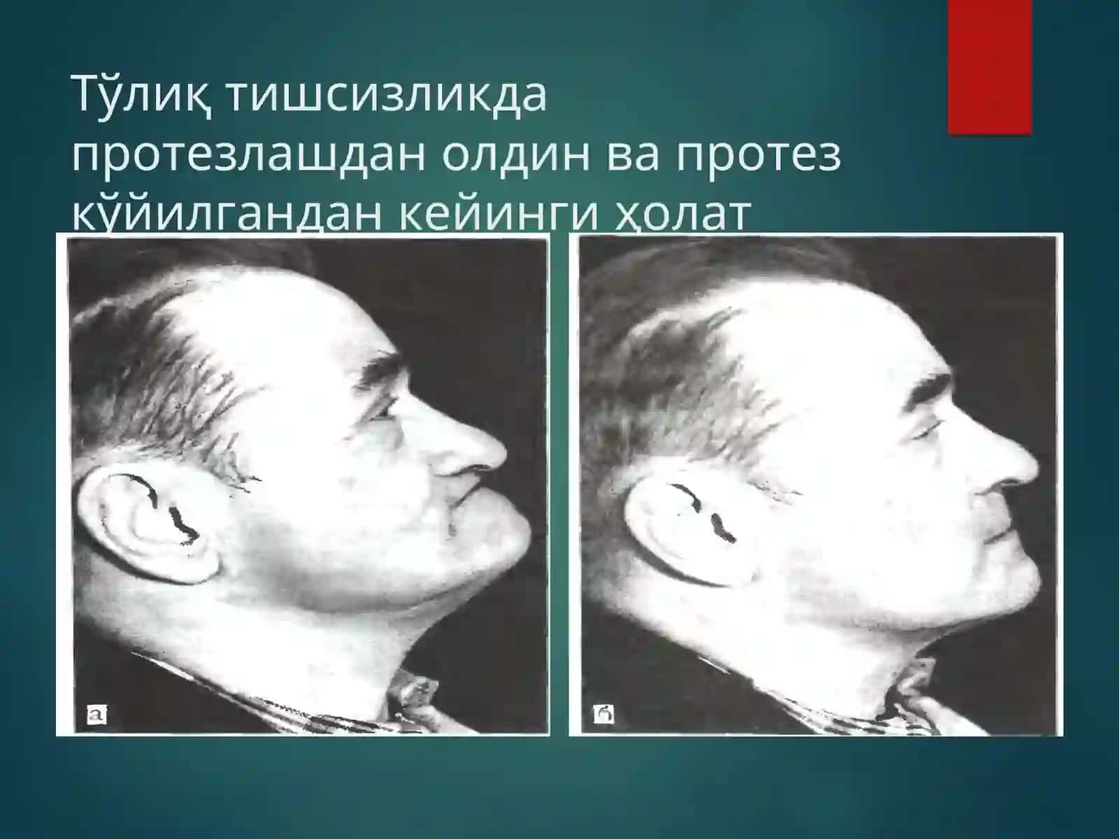 OKKLYuZIYA ASOSLARI. ANATOMIK DETЕRMINATОRLARНING TA'СIRI 4