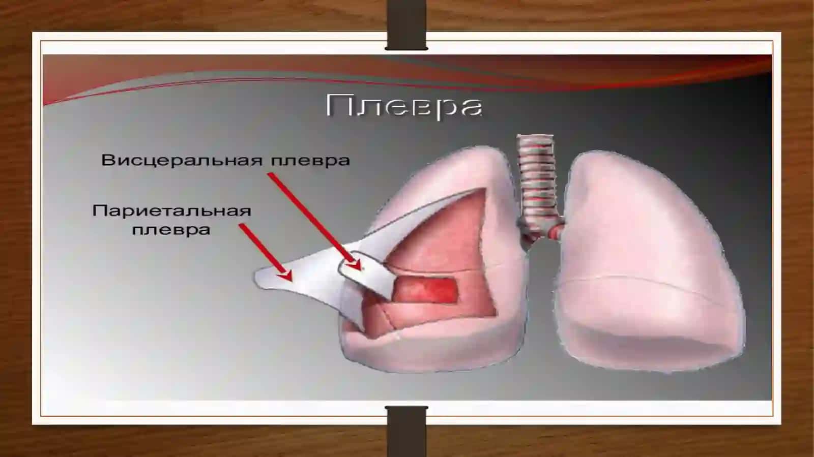 Toshkent Davlat Stomatologiya Instituti Stomatologiyafakulteti 205-"A" guruhta talabasi Dilruxsor Hamidova ning Terapiya fanidantayyorlagan taqdimoti 4