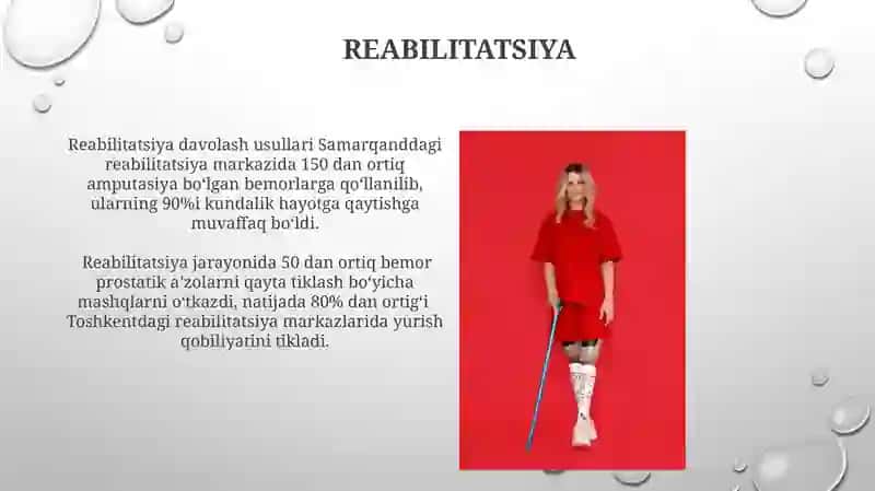 Amputatsiya hususiyatlari 4
