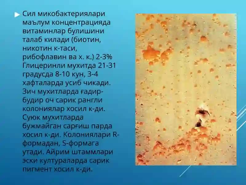 Туберкулез 4