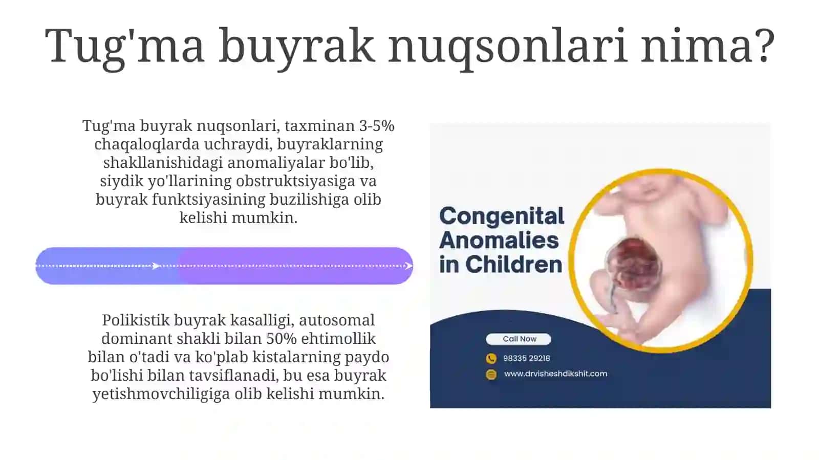 Buyraklar tug'ma nuqsonlari 4