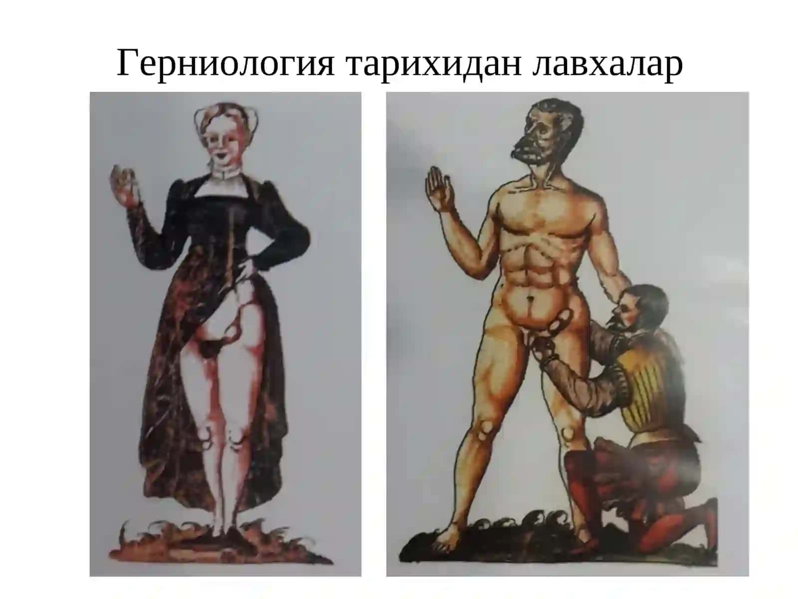 Қорин чурраларива унинг асоратлари 4