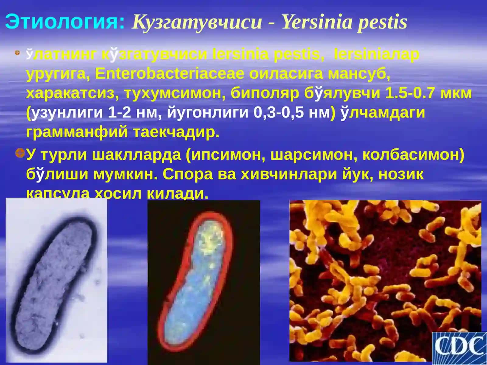 Ўлат эпидемиологияси, профилактикаси 4