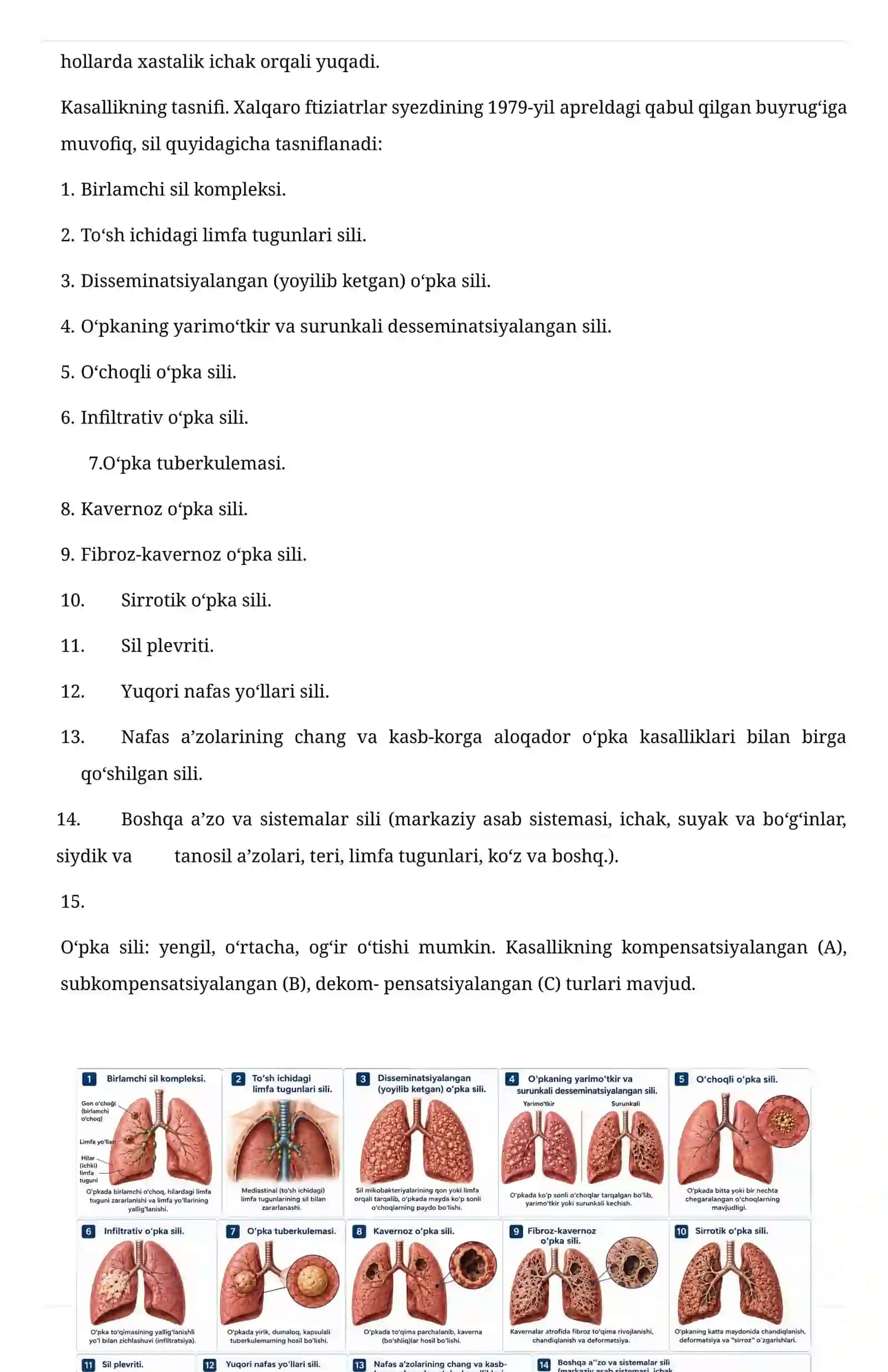 O‘pka sili (Tuberkulyoz) – Davolash va Profilaktika bo‘yicha  referat 4