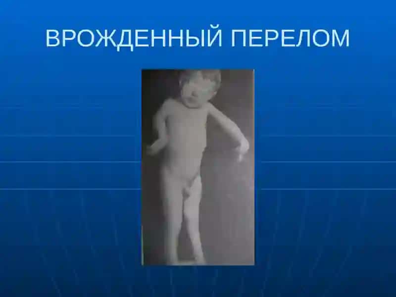 ПЕРЕЛОМЫ И ВЫВЫХИ 4