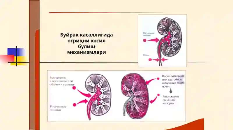 Нефритлар симптоматологияси 4