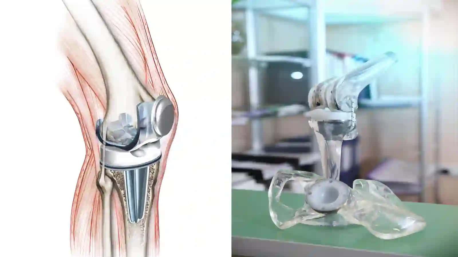 Jarrohlikda biomateriallar va implantlardan foydalanish 4