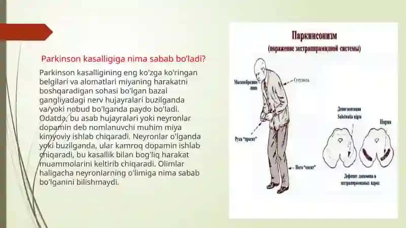 Parkinsonkasalligihaqidaumumiytushuncha 4