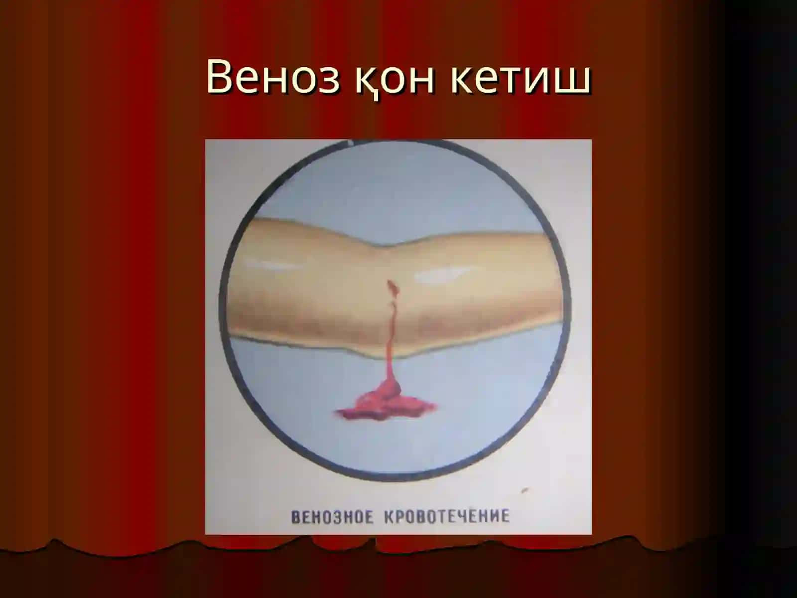 Қон кетиш 4