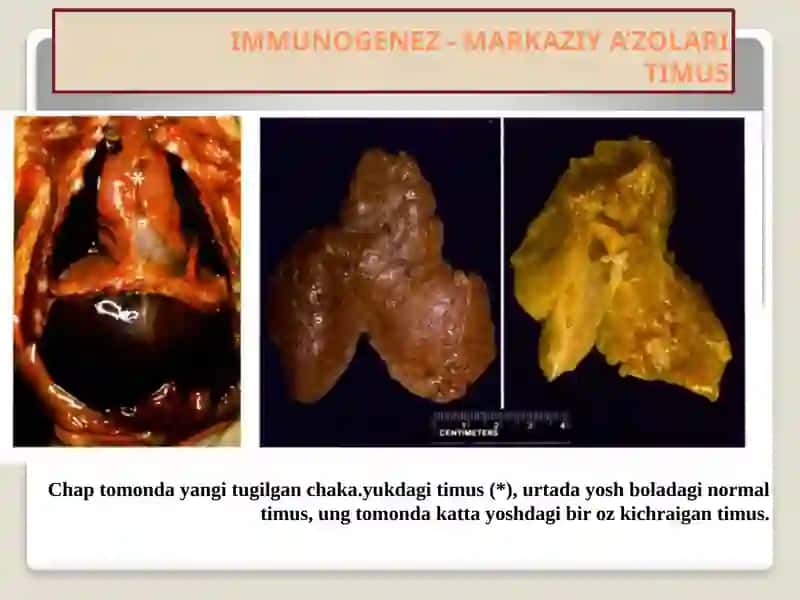 Immunapatologik jarayonlar 4