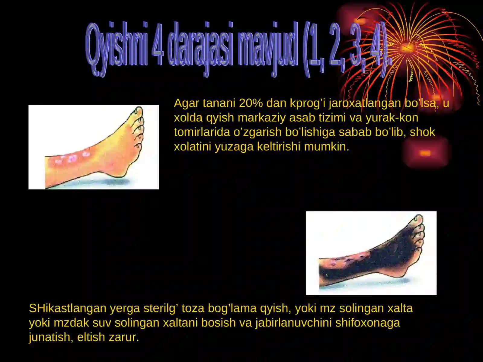 KUYISH DARAJALARI 4