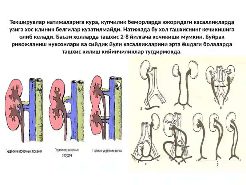 Тошкент Тиббиёт Академияси Буйракривожланиш 4