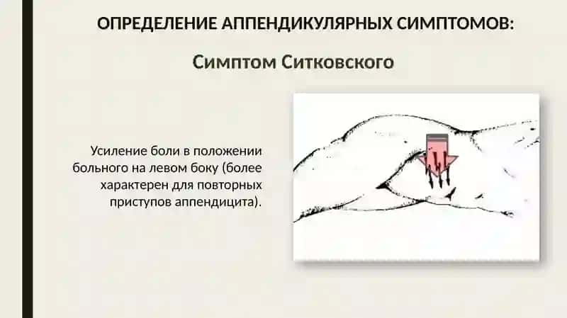 Ректальное исследование 4