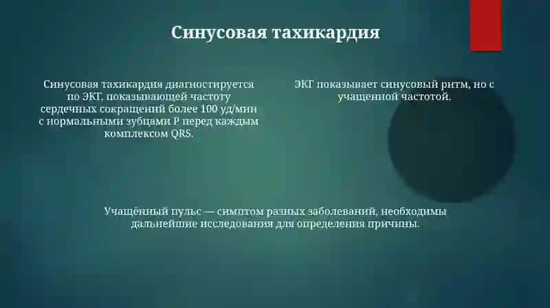 ЭКГ диагностика. Нарушение сердечного ритма 4