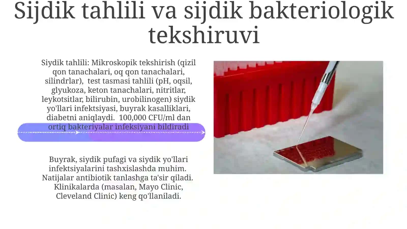 Buyrak biopsiyasi 4