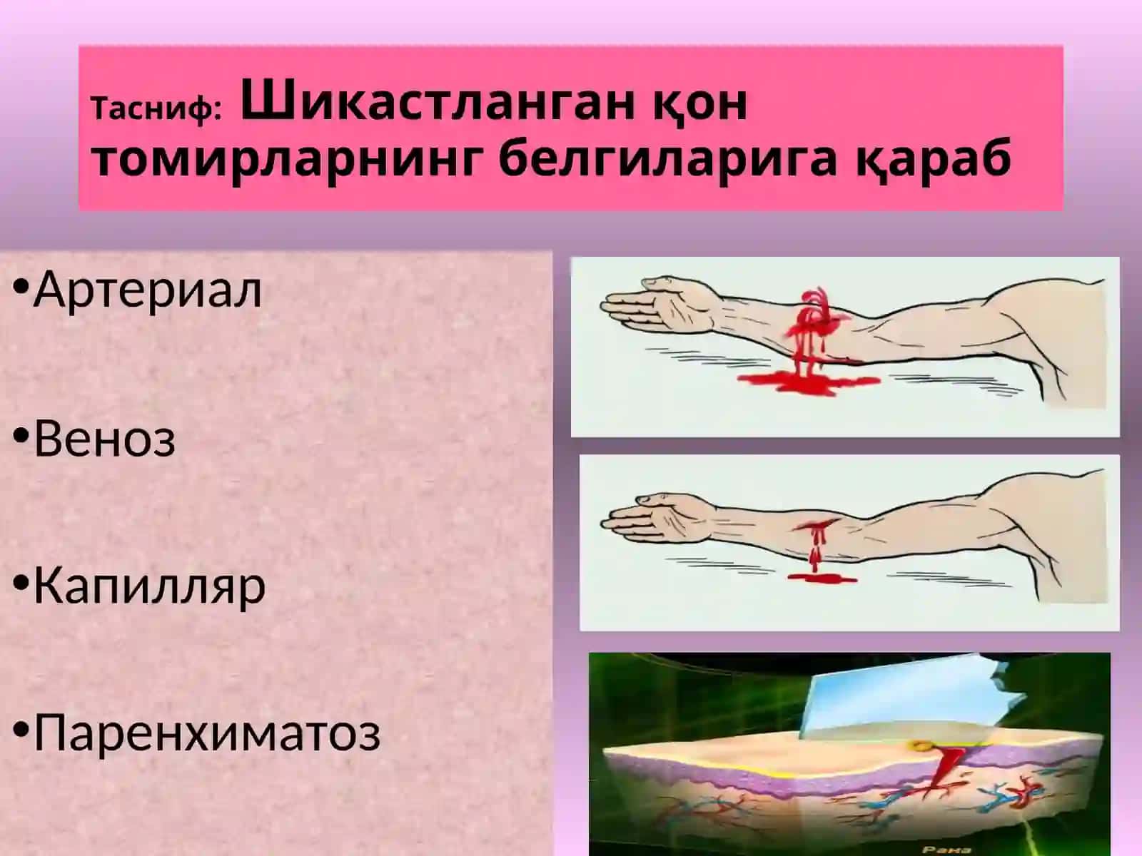 Қон Кетиш 4