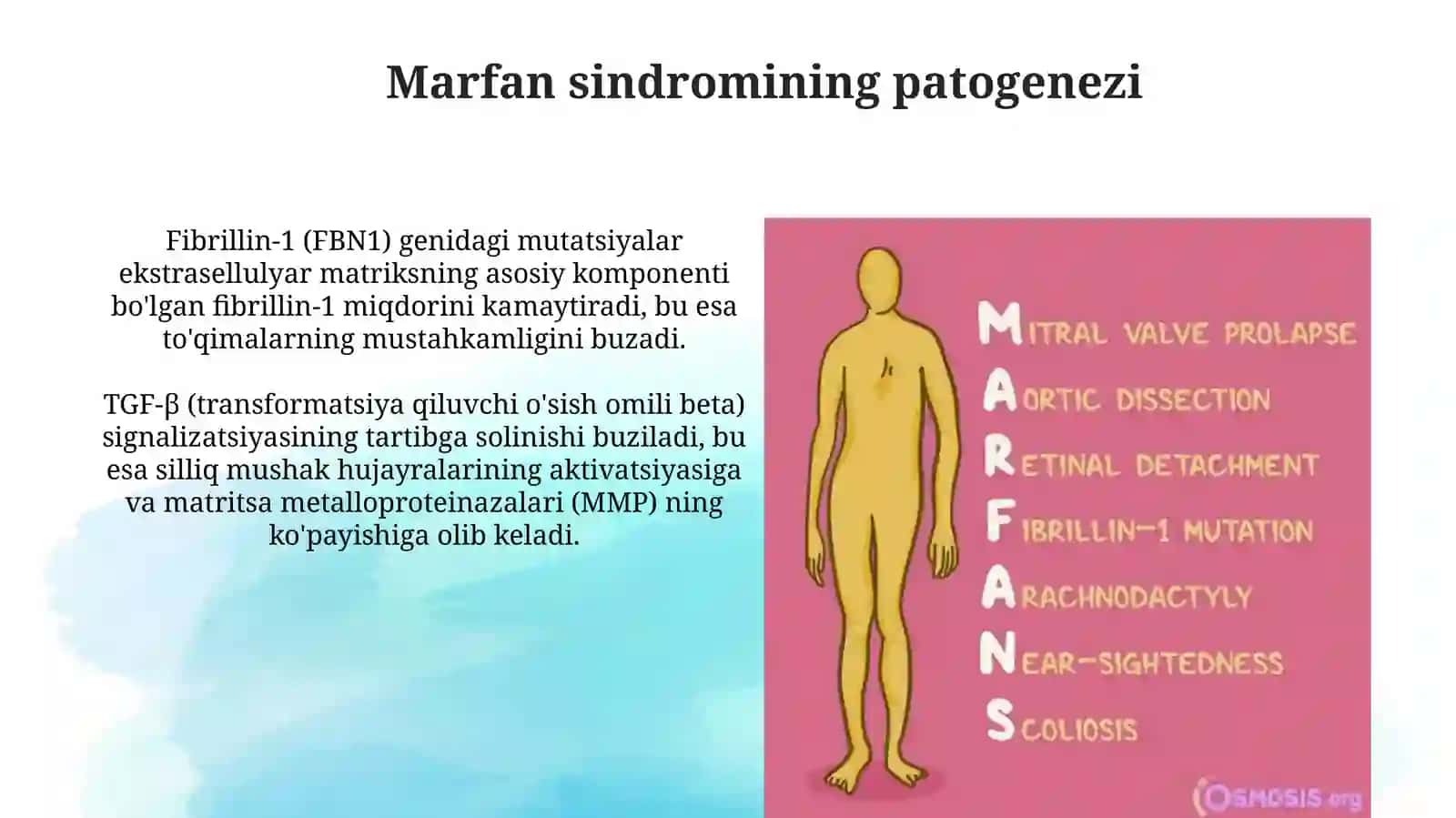 Marfansindromi 4