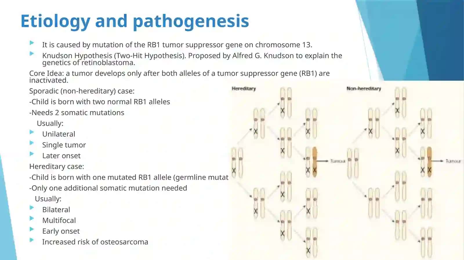 Retinoblastoma 4