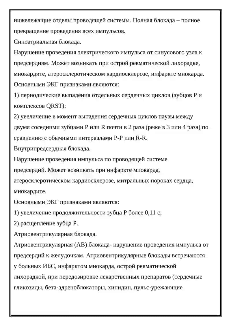 Нарушение проводимости сердца 4