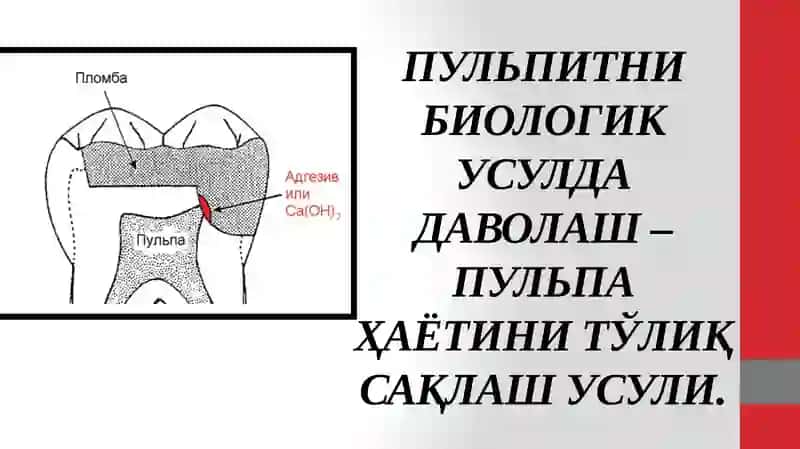 ПУЛЬПА ХАЁТЧАНЛИГИНИ САҚЛАШ УСУЛЛАРИ 4