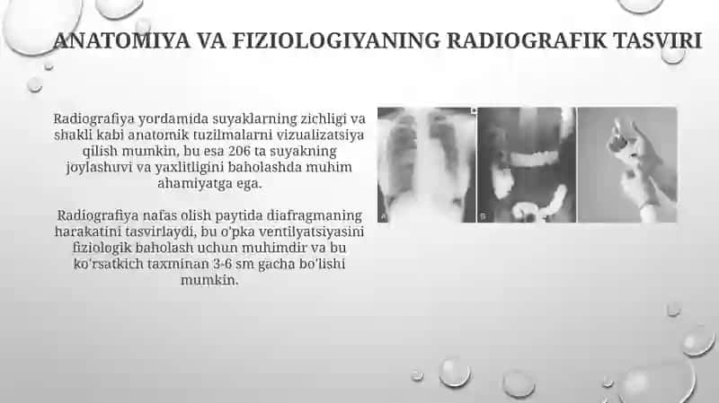 Radiografiya asoslari va texnikasi 4