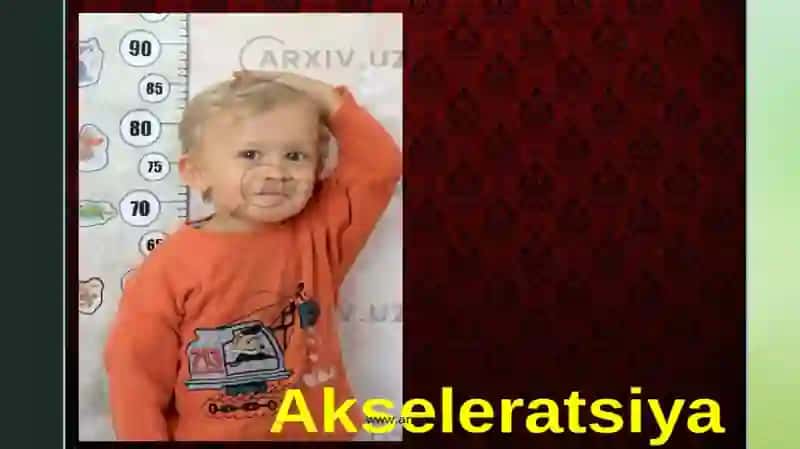Akseleratsiya .  Giperaktiv bola 4