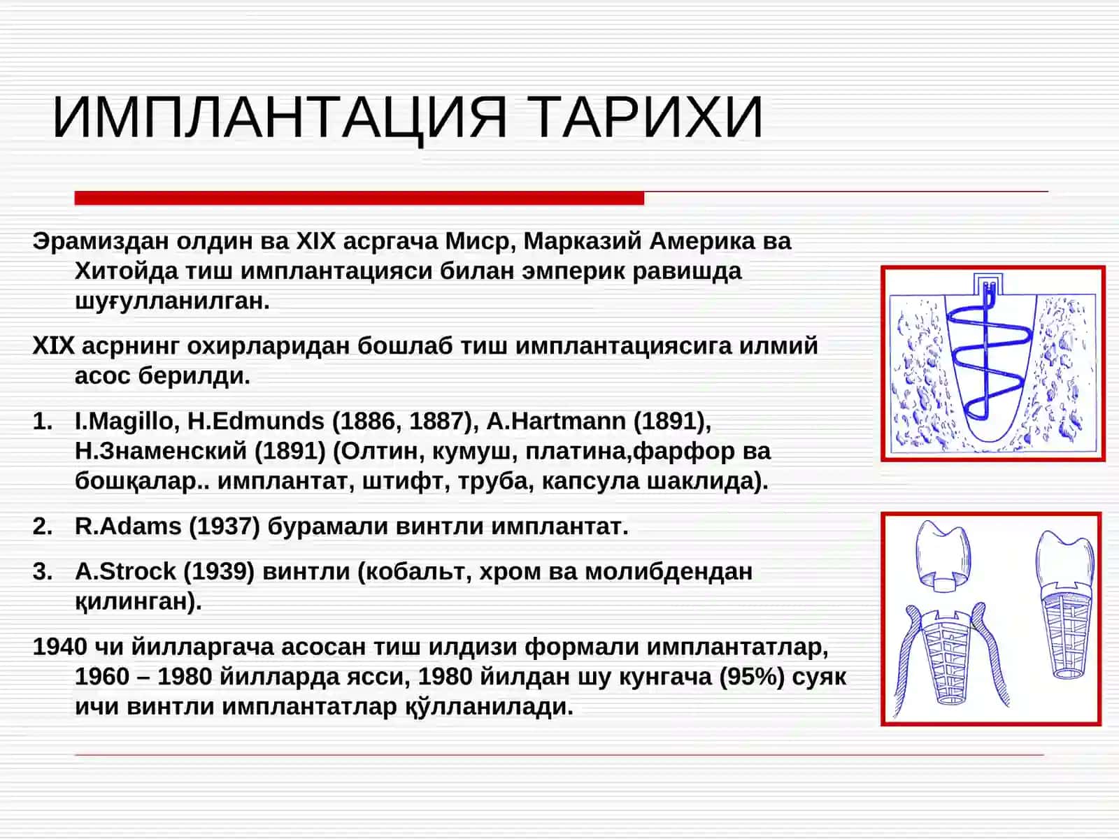 Дентал имплантация тарихи 4