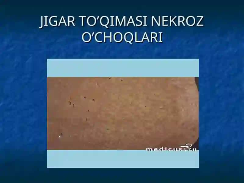 JIGARSIRROZI 4