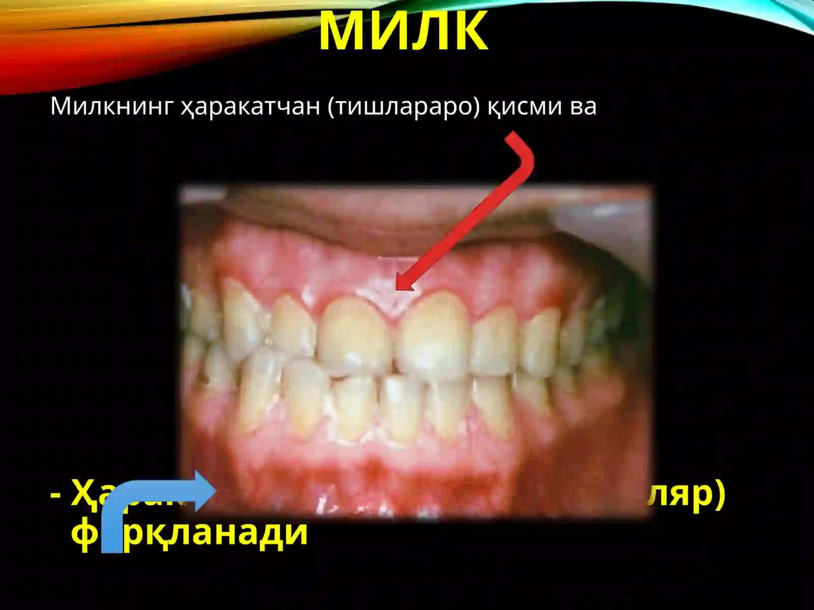 Пародонт 4