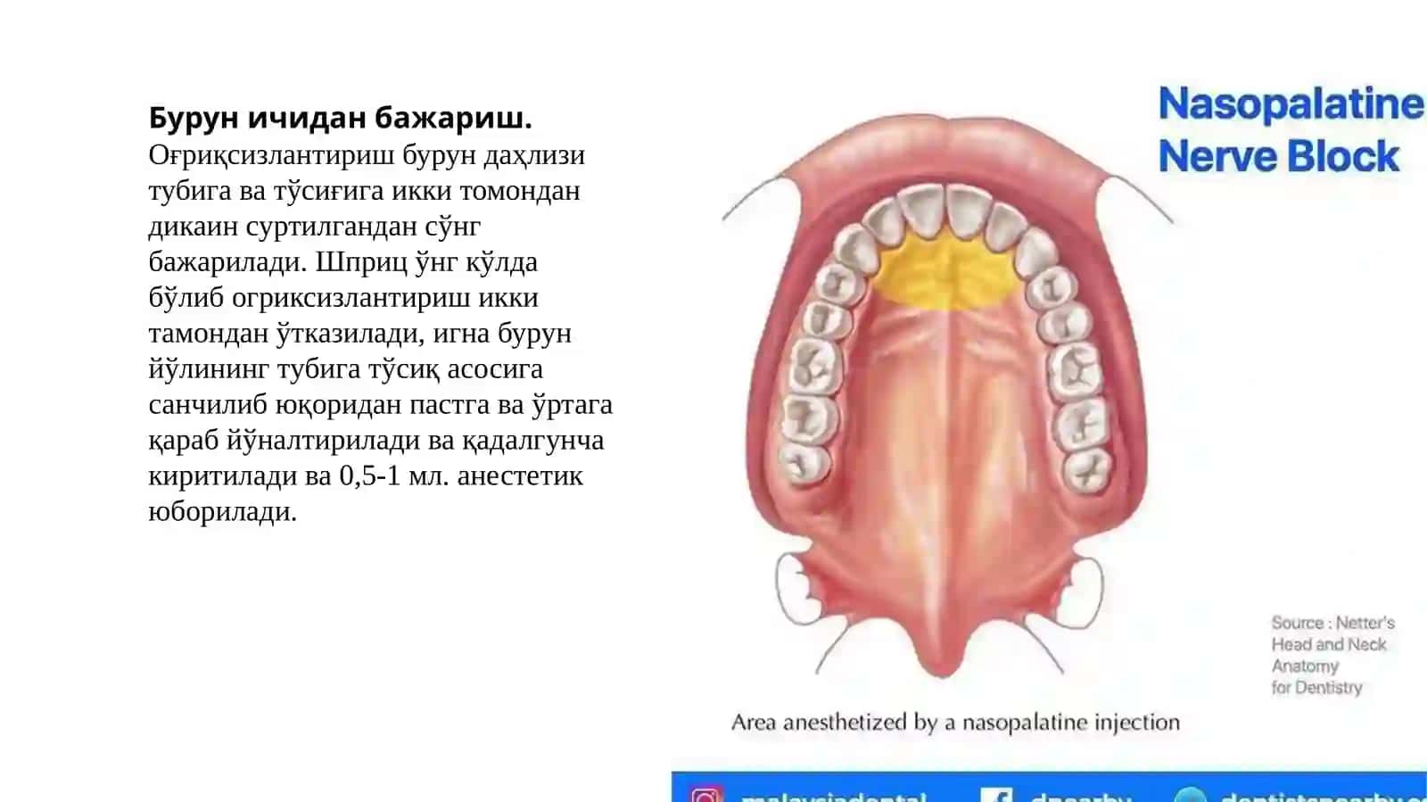 Інсизивалогъриқсизлантириш 4