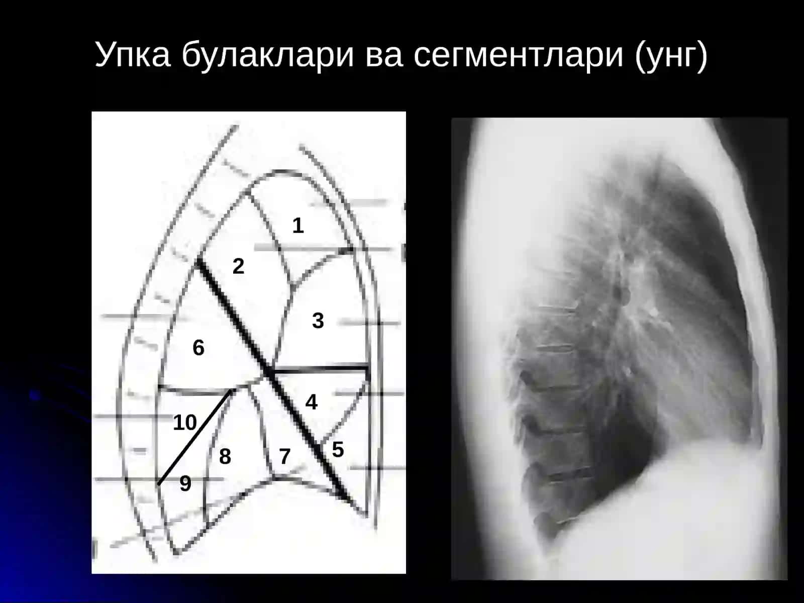 Упка Касалликларининг Нур Ташхиси 4