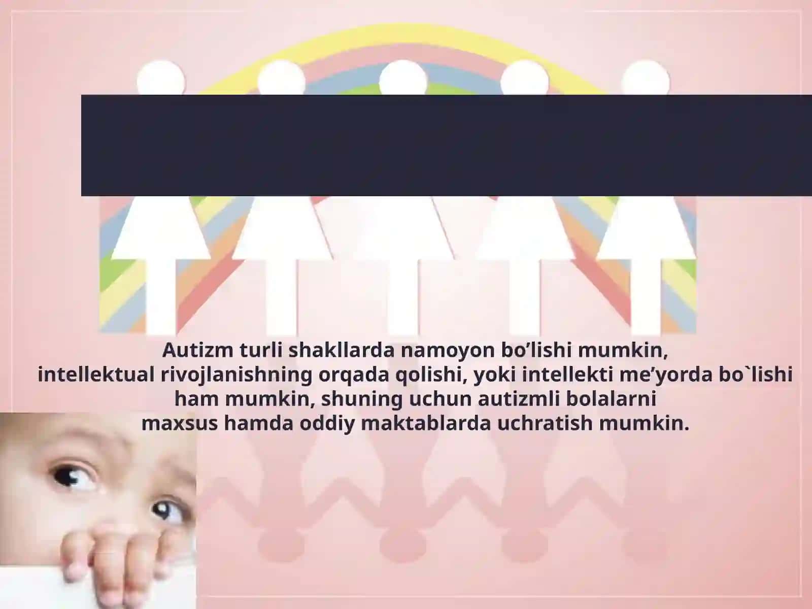 Autizm sindromiga ega bo‘lgan bolalar 4