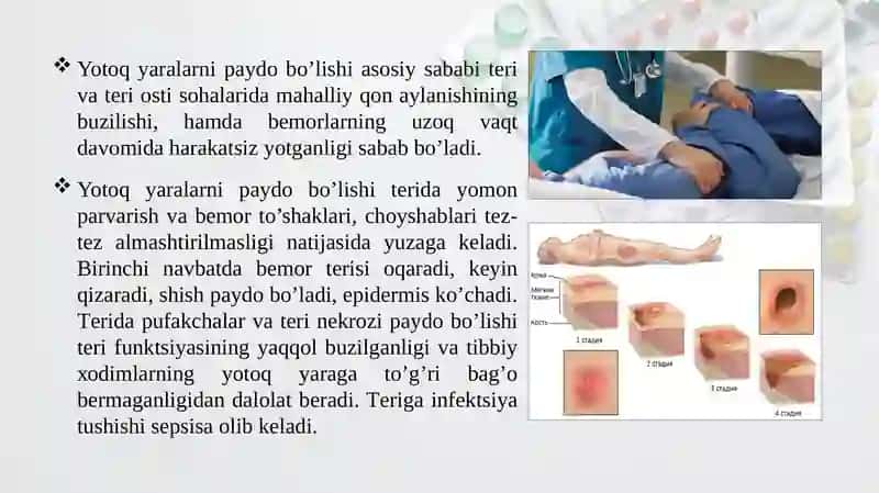 Yotоq yаrаlаri davоlаsh 4