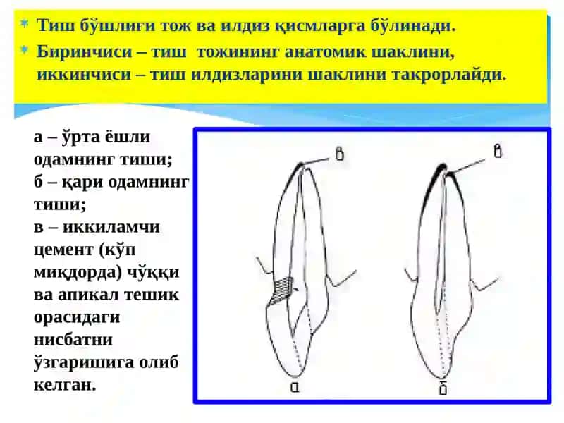 КЛИНИК ЭНДОДОНТИЯ 4