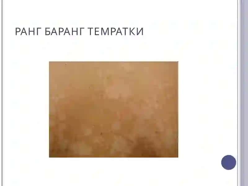 ТЕРИНИНГ ЗАМБУРУҒЛИ ИНФЕКЦИЯЛАРИ 4