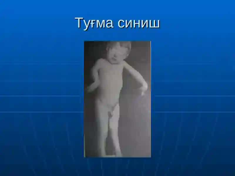 Суякларнинг синиши ва чикиши 4