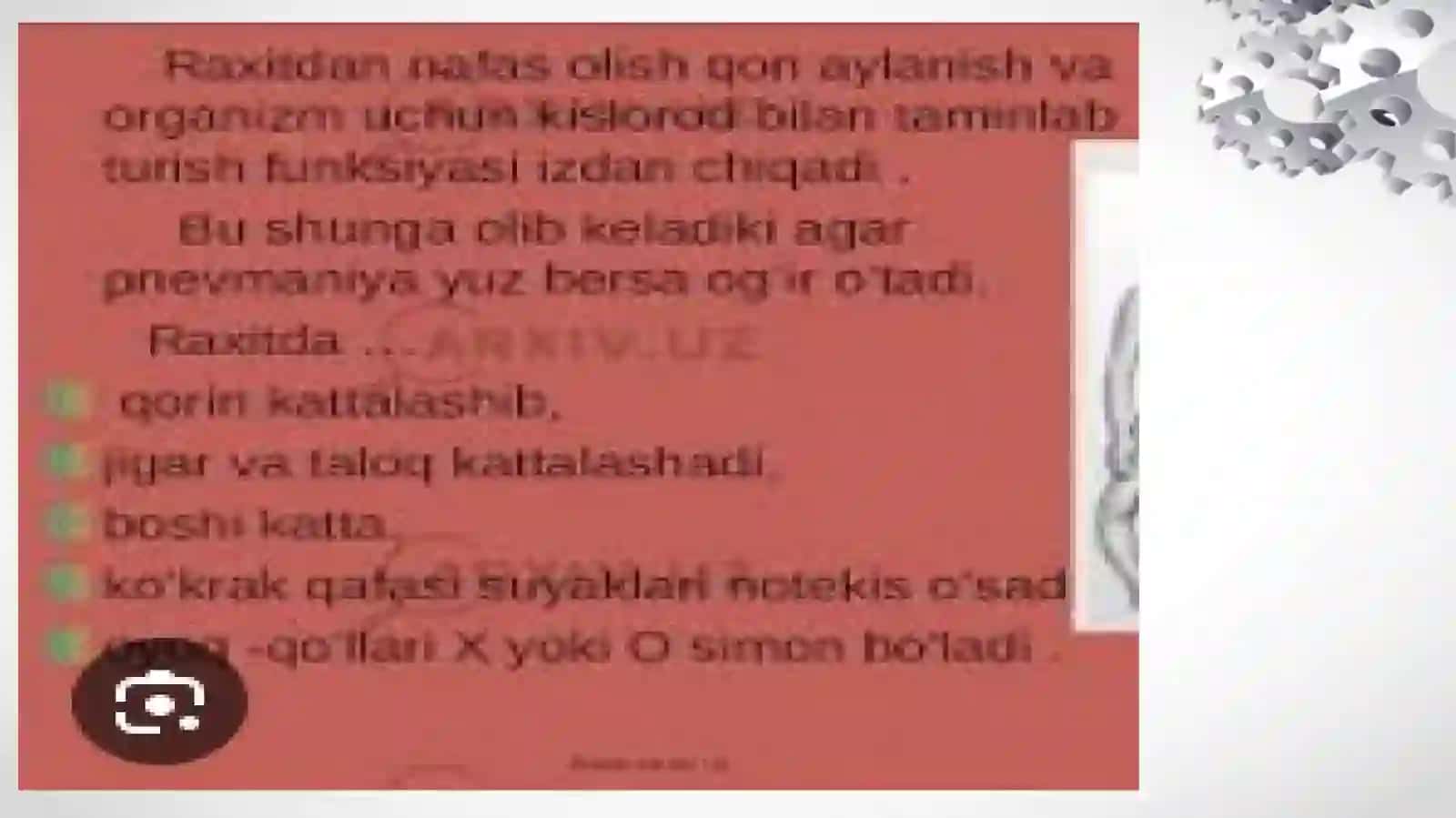 Raxit Kasalligi 4