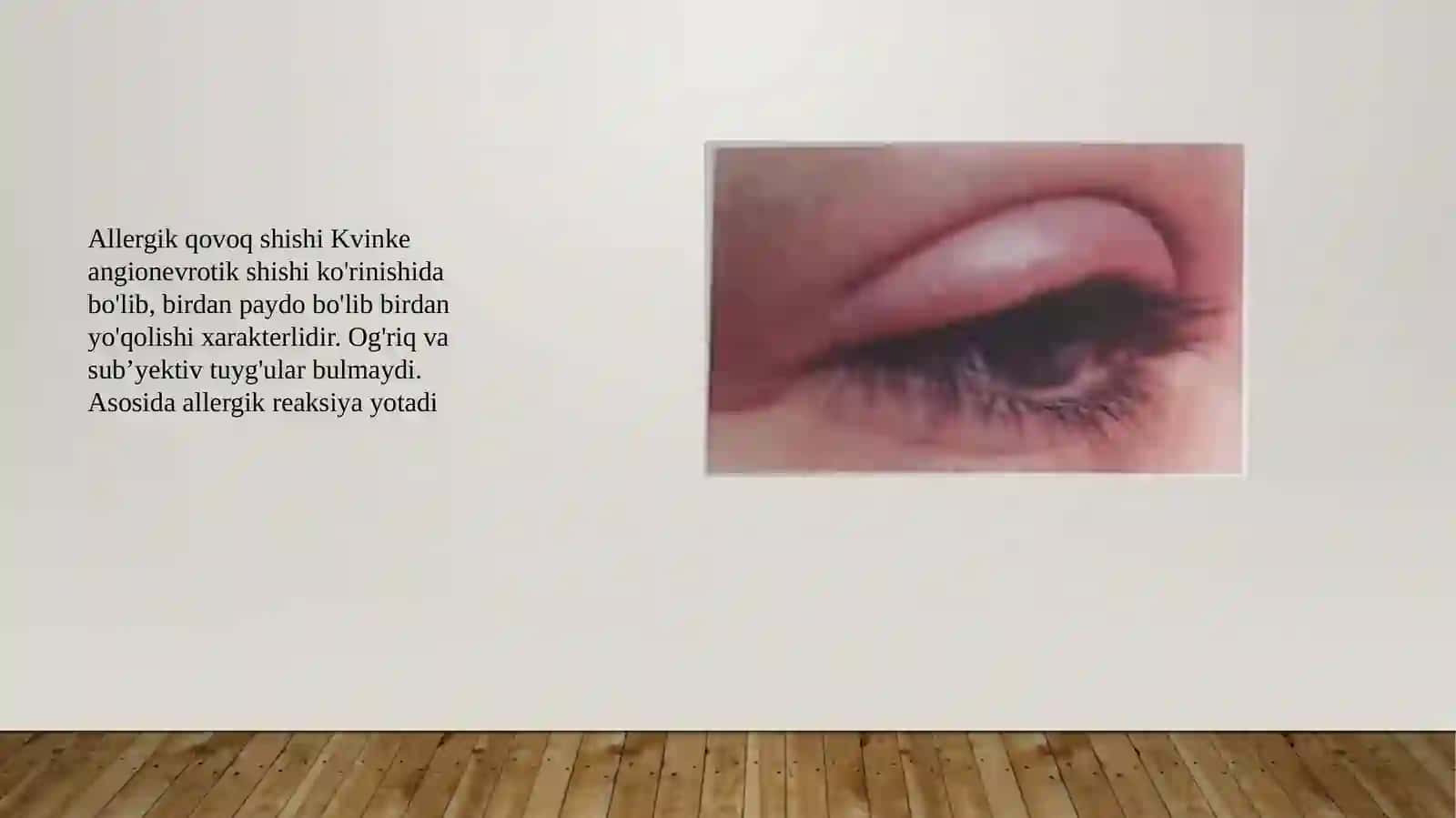Qovoq tuzilishi va kassaliklar 4