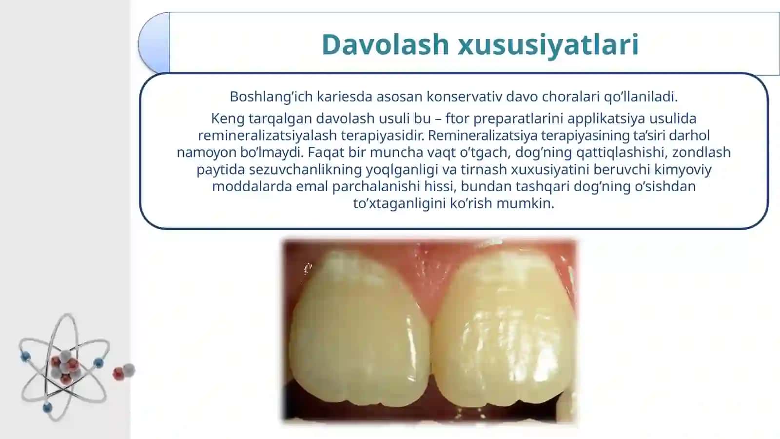 TISH KARIESINI KONSERVATIV DAVOLASHUSULLARI. KARIES PROFILAKTIKASI 4