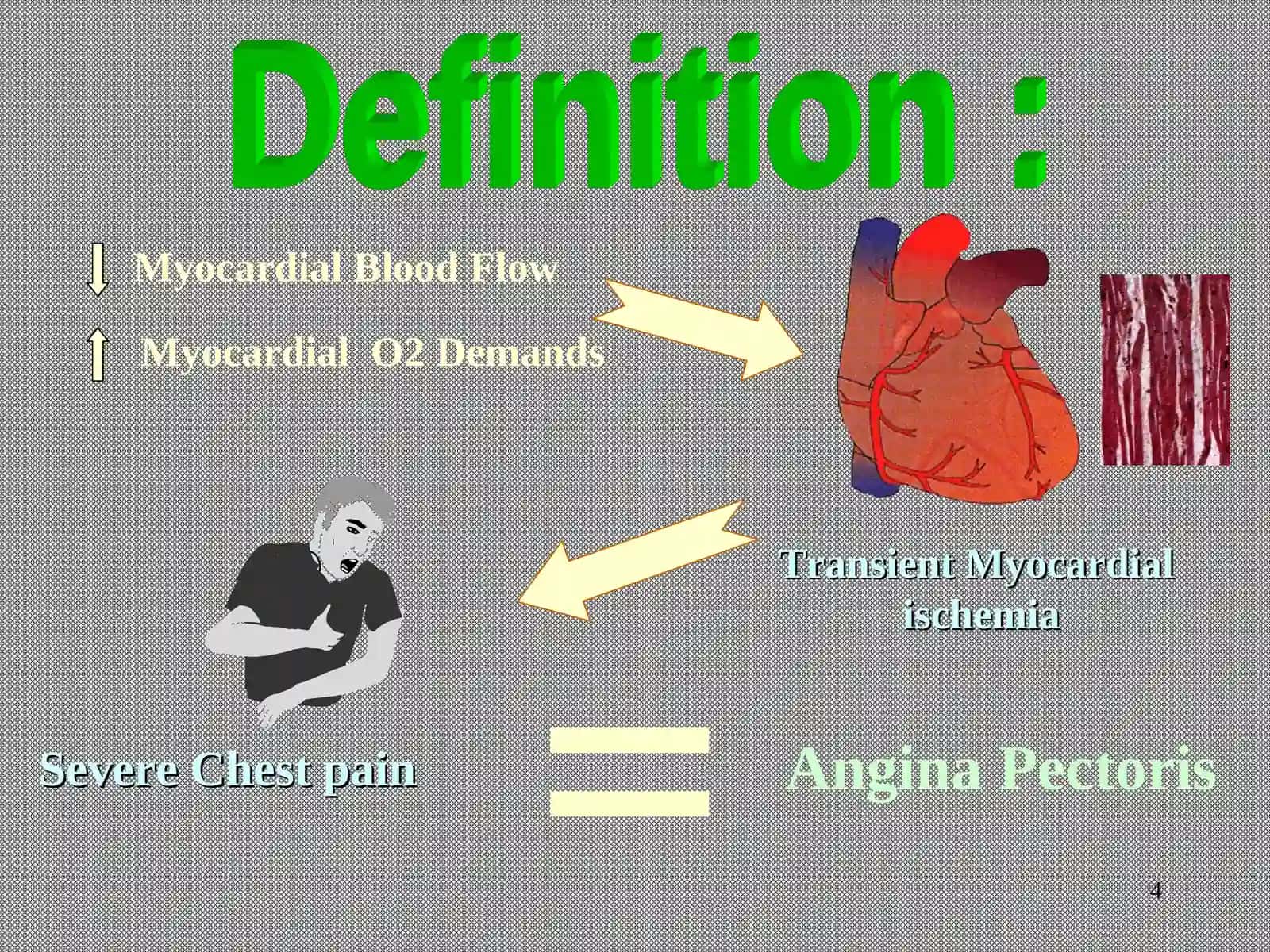 Angina Pectoris 4
